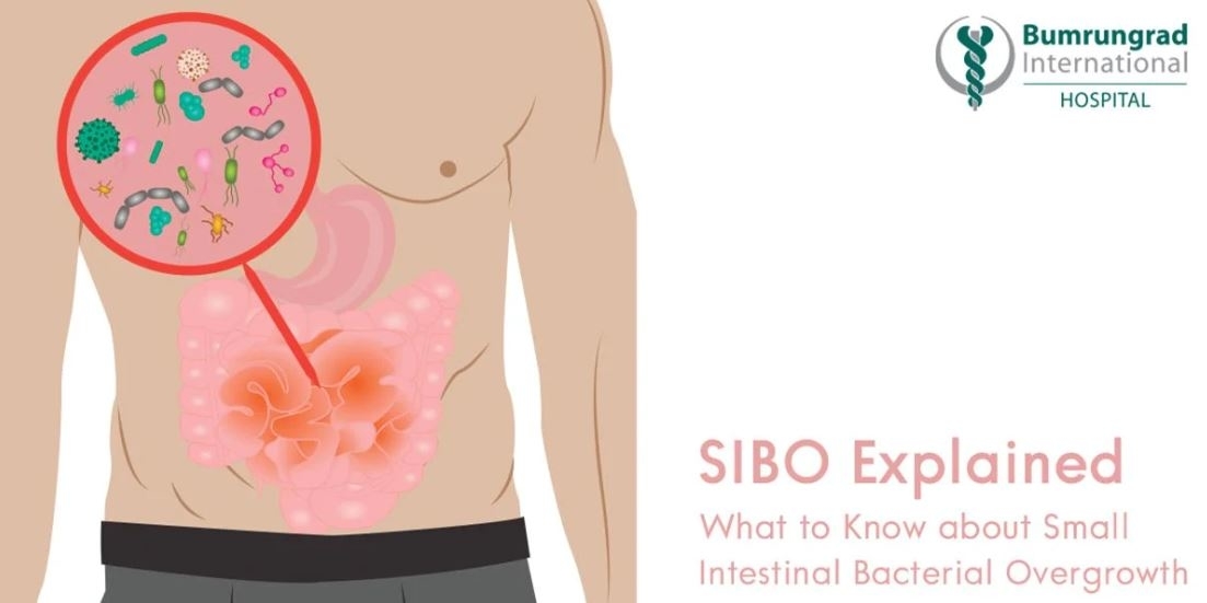 Sibo Explained What To Know About Small Intestinal Bacterial Overgrowth 6516
